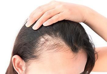 Hair Disorder Treatment in Ponchatoula, LA