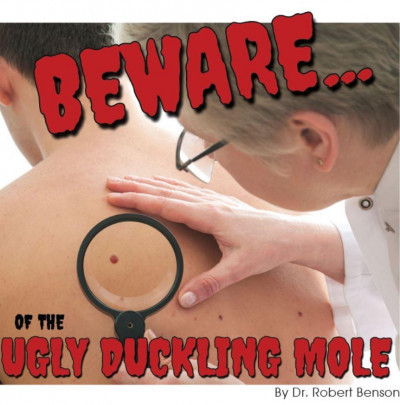 Mole Spot Check